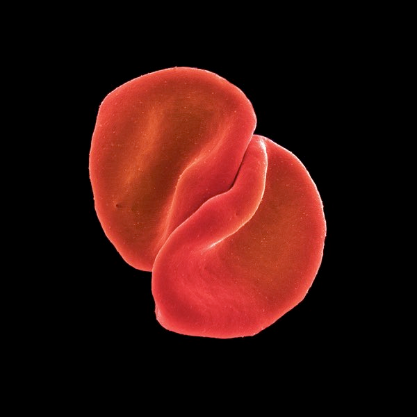 On a black background, two red blood cells against each other in the center are like petals of a flower.